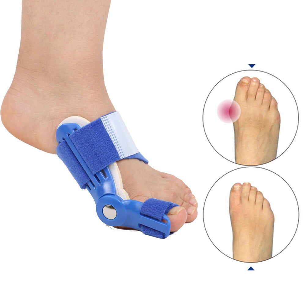 GleamiqueBunion Orthopedic Bunion Corrector (1 Pair) by GleamiqueCare