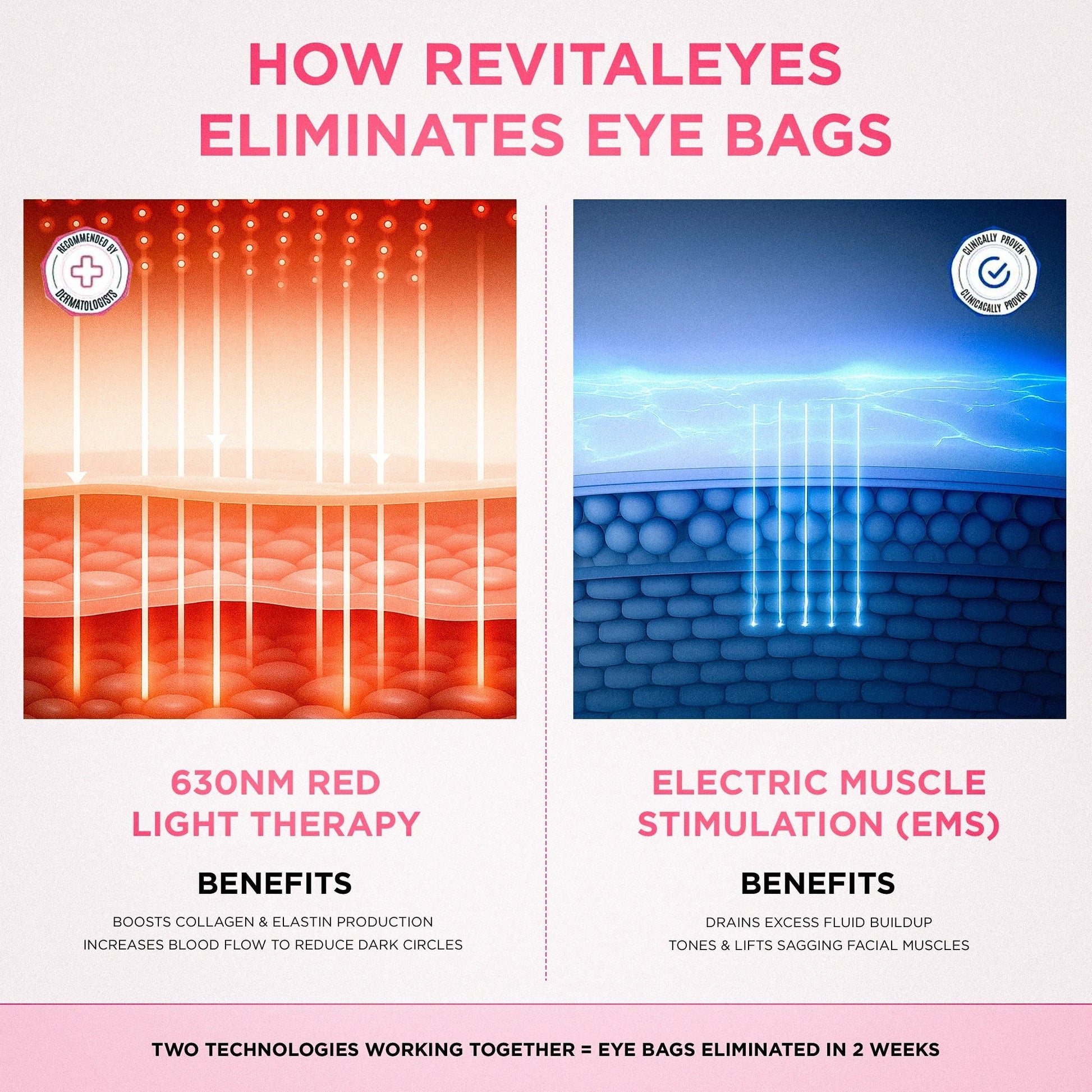 2-in-1 Red Light Therapy + EMS To Erase Eye Bags by GleamiqueCare